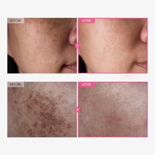TOSOWOONG Arbutin TXA Spot Cream 50ml